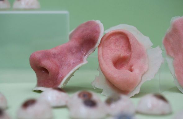 Prótesis de nariz y oreja elaboradas con impresoras 3D. Los investigadores las 
