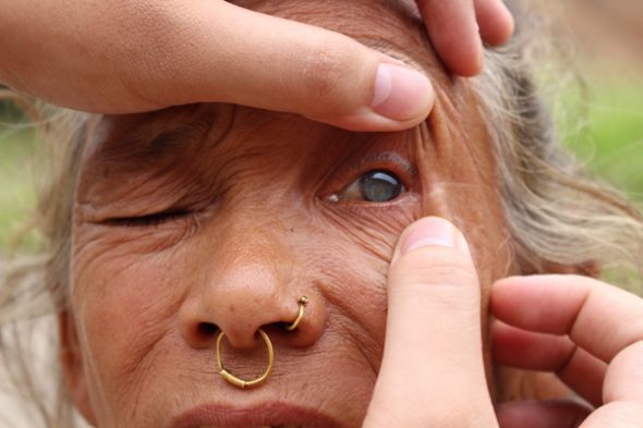 Entre los pacientes del oftalmólogo nepalí se encuentra Thuli Maya.
